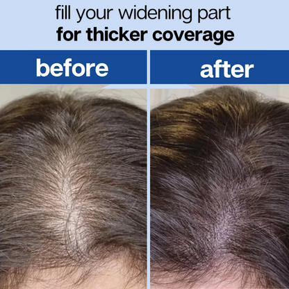 Root Revival - Hair Growth Roll-On Serum