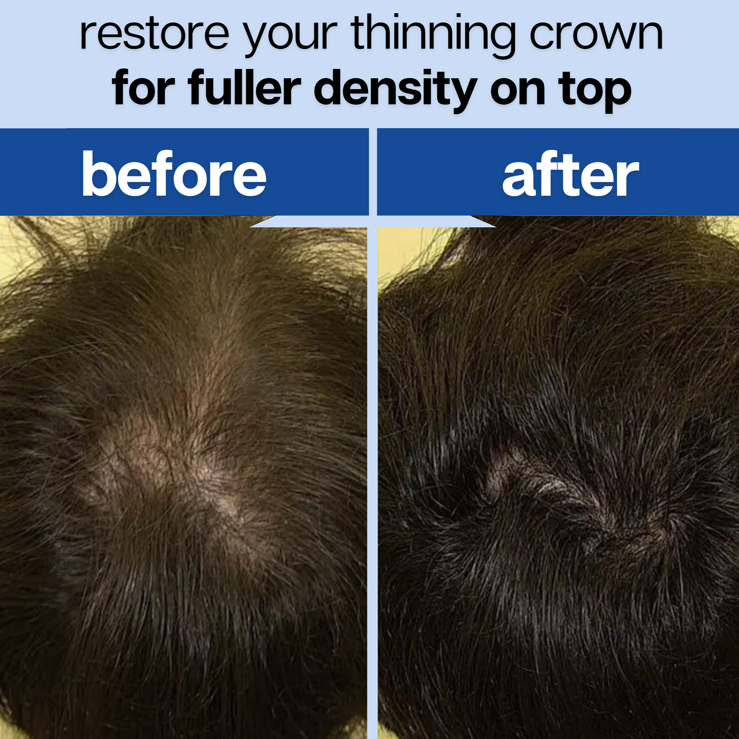 Root Revival - Hair Growth Roll-On Serum