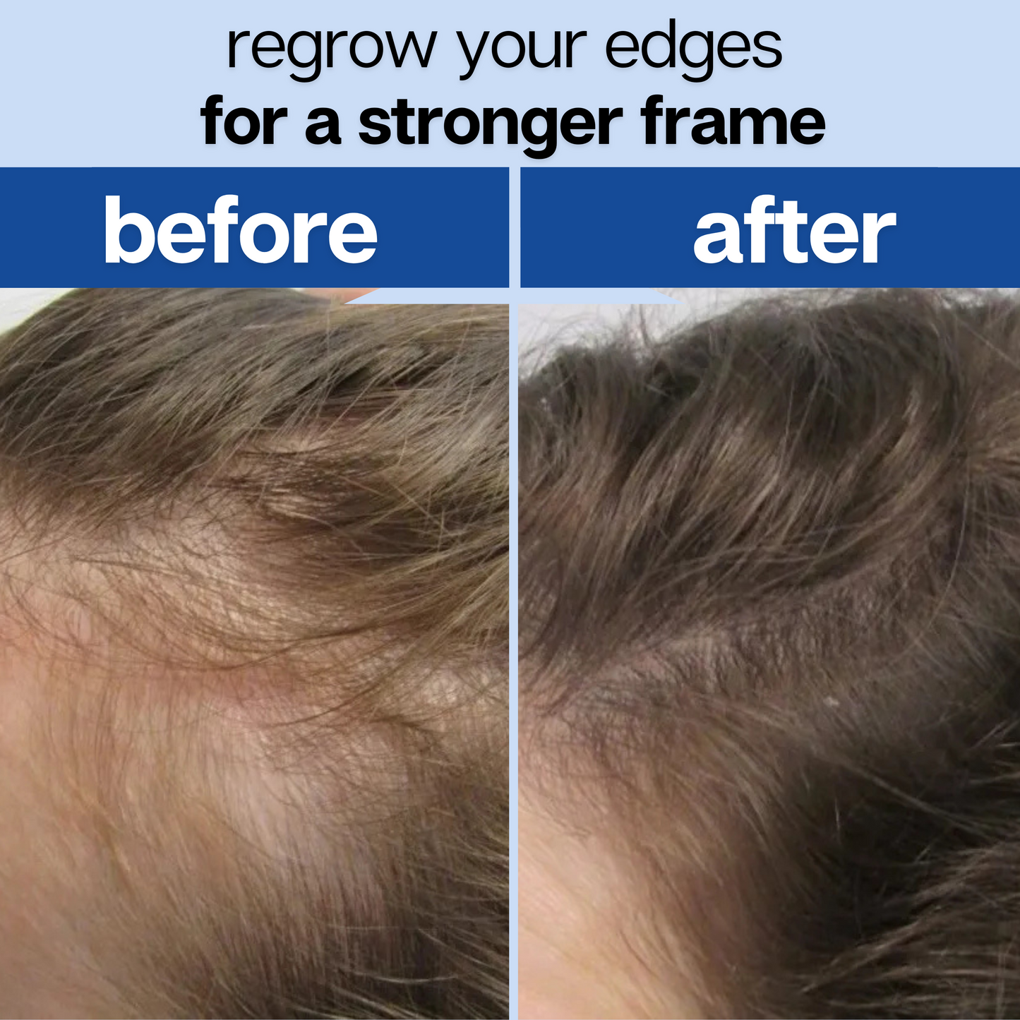 Root Revival - Hair Growth Roll-On Serum