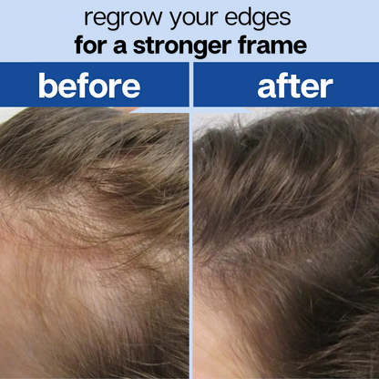 Root Revival - Hair Growth Roll-On Serum