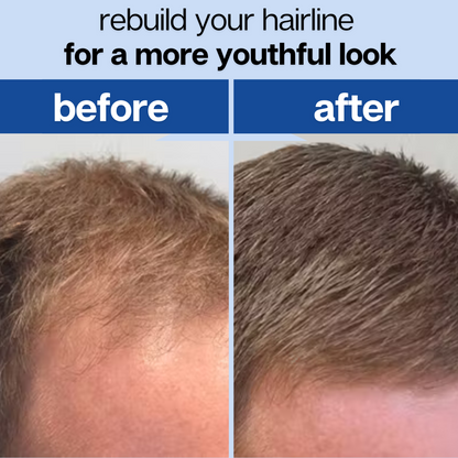 Root Revival - Hair Growth Roll-On Serum